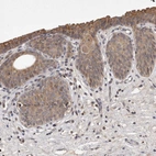 Anti-UBE3D Antibody