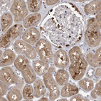 Immunohistochemical staining of human kidney shows weak cytoplasmic positivity in cells in tubules.