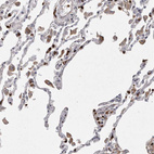 Immunohistochemical staining of human lung shows moderate cytoplasmic positivity in macrophages.