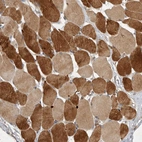 Immunohistochemical staining of human skeletal muscle shows strong cytoplasmic positivity in myocytes.
