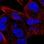 Immunofluorescent staining of human cell line RH-30 shows localization to rods & rings.