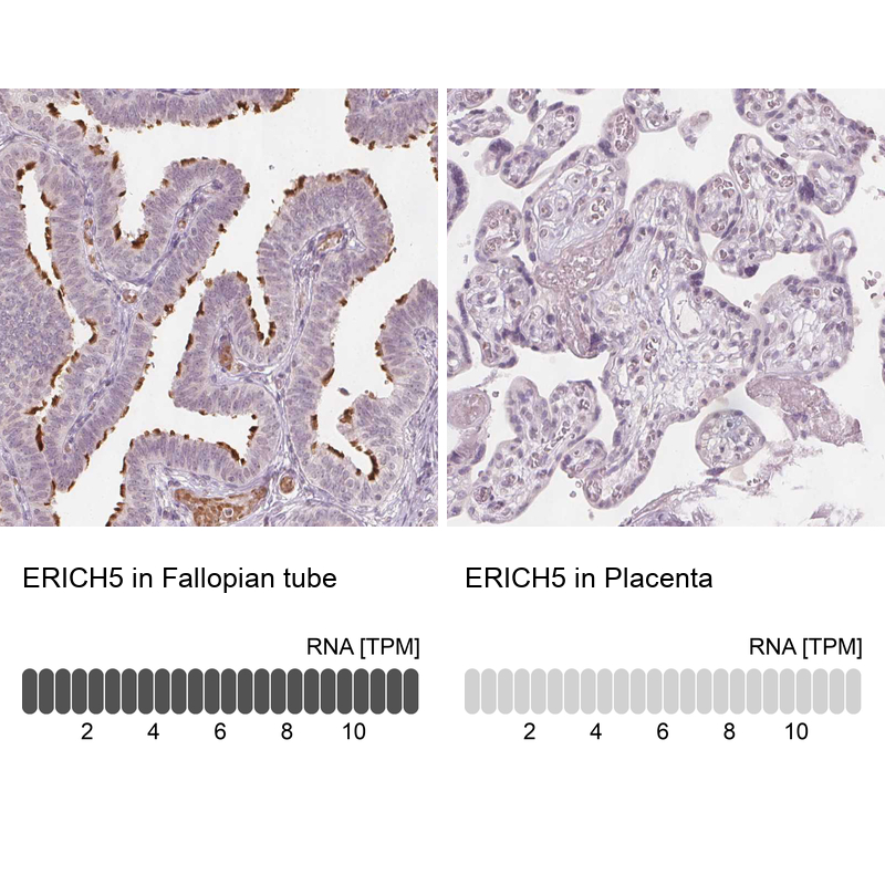 Anti-ERICH5 Antibody