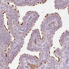 Immunohistochemical staining of human fallopian tube shows strong positivity in cilia in glandular cells.