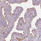 Immunohistochemical staining of human fallopian tube shows strong positivity in cilia in glandular cells.
