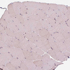 Immunohistochemical staining of human skeletal muscle shows no positivity in myocytes as expected.