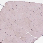Immunohistochemical staining of human skeletal muscle shows no positivity in myocytes as expected.