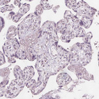 Immunohistochemical staining of human placenta shows no positivity in trophoblastic cells as expected.