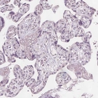 Immunohistochemical staining of human placenta shows no positivity in trophoblastic cells as expected.