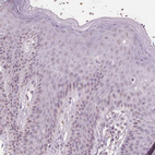 Immunohistochemical staining of human skin shows no positivity in squamous epithelial cells as expected.
