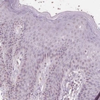 Immunohistochemical staining of human skin shows no positivity in squamous epithelial cells as expected.