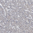 Immunohistochemical staining of human liver shows low expression as expected.