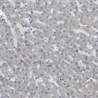 Anti-KRT20 Antibody