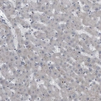 Immunohistochemical staining of human liver shows low expression as expected.