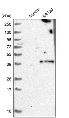Western blot analysis in control (vector only transfected HEK293T lysate) and KRT20 over-expression lysate (Co-expressed with a C-terminal myc-DDK tag (~3.1 kDa) in mammalian HEK293T cells, LY402725).