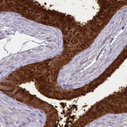 Immunohistochemical staining of human epididymis shows strong cytoplasmic positivity in glandular cells.
