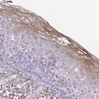 Immunohistochemical staining of human squamous epithelia shows moderate cytoplasmic positivity in squamous epithelial cells.