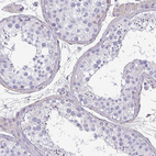 Immunohistochemical staining of human testis shows no positivity in cells in seminiferous ducts as expected.