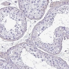 Immunohistochemical staining of human testis shows no positivity in cells in seminiferous ducts as expected.