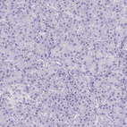 Immunohistochemical staining of human pancreas shows no positivity in exocrine glandular cells as expected.