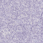 Anti-ECM1 Antibody