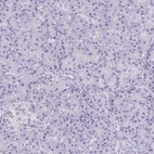 Immunohistochemical staining of human pancreas shows no positivity in exocrine glandular cells as expected.