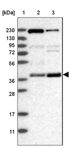 Lane 1: Marker [kDa] 230, 130, 95, 72, 56, 36, 28, 17, 11_br/_Lane 2: Human cell line RT-4_br/_Lane 3: Human cell line U-251MG sp