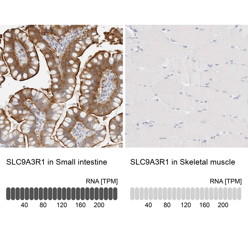 Anti-SLC9A3R1 Antibody