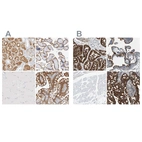 Immunohistochemical staining of human kidney, placenta, skeletal muscle and small intestine using Anti-SLC9A3R1 antibody HPA027247 (A) shows similar protein distribution across tissues to independent antibody HPA009672 (B).