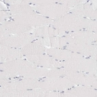 Immunohistochemical staining of human skeletal muscle shows no positivity in myocytes as expected.