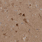 Anti-KIF21B Antibody