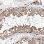 Immunohistochemical staining of human testis shows moderate granular positivity in cytoplasm in cells in seminiferous ducts.