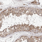 Immunohistochemical staining of human testis shows moderate granular positivity in cytoplasm in cells in seminiferous ducts.