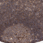 Immunohistochemical staining of human lymphoid tissues shows strong granular positivity in cytoplasm in non-germinal center cells.