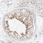 Immunohistochemical staining of human testis shows moderate cytoplasmic positivity in cells in seminiferous ducts.