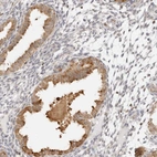 Immunohistochemical staining of human endometrium shows moderate cytoplasmic positivity in glandular cells.