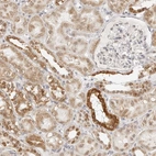 Immunohistochemical staining of human kidney shows moderate cytoplasmic positivity in cells in tubules.