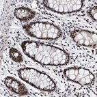 Immunohistochemical staining of human rectum shows strong nuclear positivity in glandular cells.