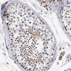 Immunohistochemical staining of human testis shows moderate nuclear positivity in a subset of cells in seminiferous ducts.