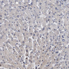 Immunohistochemical staining of human liver shows no positivity in hepatocytes as expected.