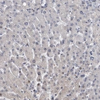 Immunohistochemical staining of human liver shows no positivity in hepatocytes as expected.