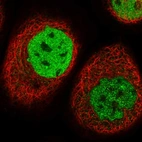 Immunofluorescent staining of human cell line A-431 shows localization to nucleoplasm.