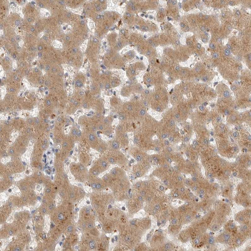 Anti-GNE Antibody