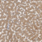 Anti-GNE Antibody