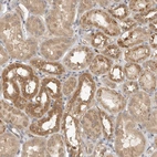 Immunohistochemical staining of human kidney shows moderate cytoplasmic positivity in cells in tubules.