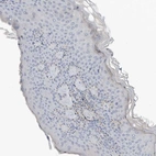 Immunohistochemical staining of human skin shows no positivity in squamous epithelial cells as expected.