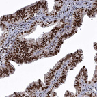 Immunohistochemical staining of human fallopian tube shows strong nuclear positivity in glandular cells.