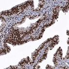 Immunohistochemical staining of human fallopian tube shows strong nuclear positivity in glandular cells.