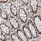 Immunohistochemical staining of human gastrointestinal shows strong nuclear positivity in glandular cells.