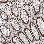 Immunohistochemical staining of human gastrointestinal shows strong nuclear positivity in glandular cells.
