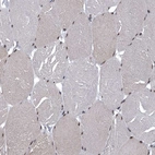 Immunohistochemical staining of human skeletal muscle shows moderate nuclear positivity in myocytes.